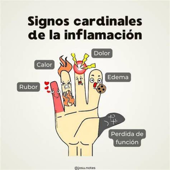 ¿Cuáles son los puntos cardinales de la inflamacion?