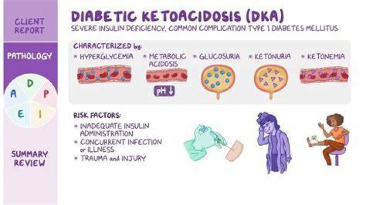 What blood sugar causes DKA?