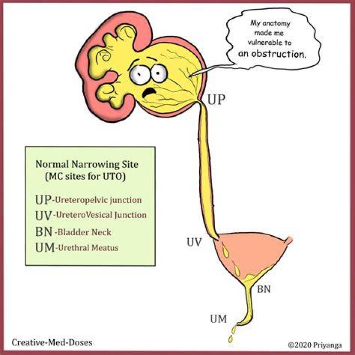 What is the medical term for abnormal narrowing of the ureter?